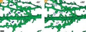 Rückbildung dendritischer Dornen an den Nervenzellen, Grafik Rückbildung dendritischer Dornen an den Nervenzellen, Grafik