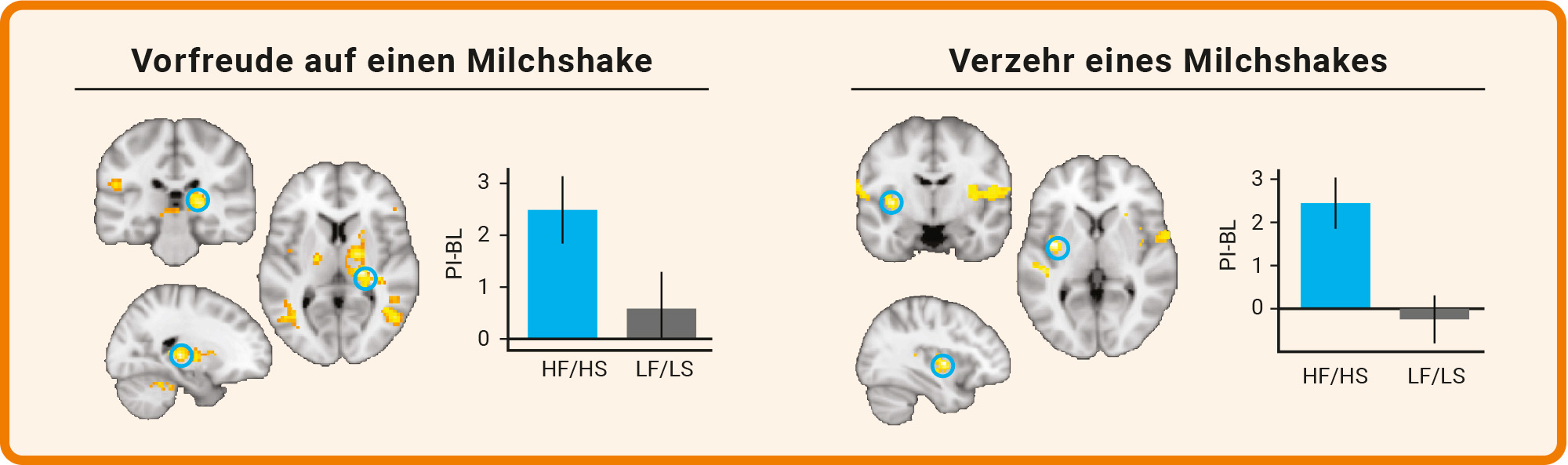 Die Abbildung zeigt zwei rMRT-Aufnahmen.