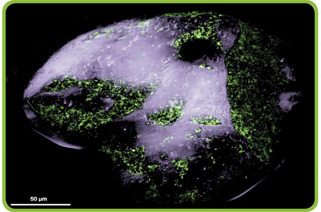 Fluoreszenzmikroskop-Aufnahme eines Sandkorns mit grün eingefärbten Bakterien.